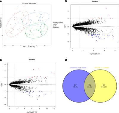 Integrated Multichip Analysis Identifies Potential Key Genes in the Pathogenesis of Nonalcoholic Steatohepatitis